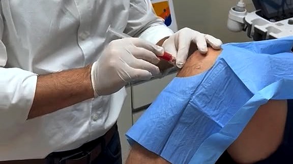 Infiltra&ccedil;&atilde;o guiada aplicada no joelho